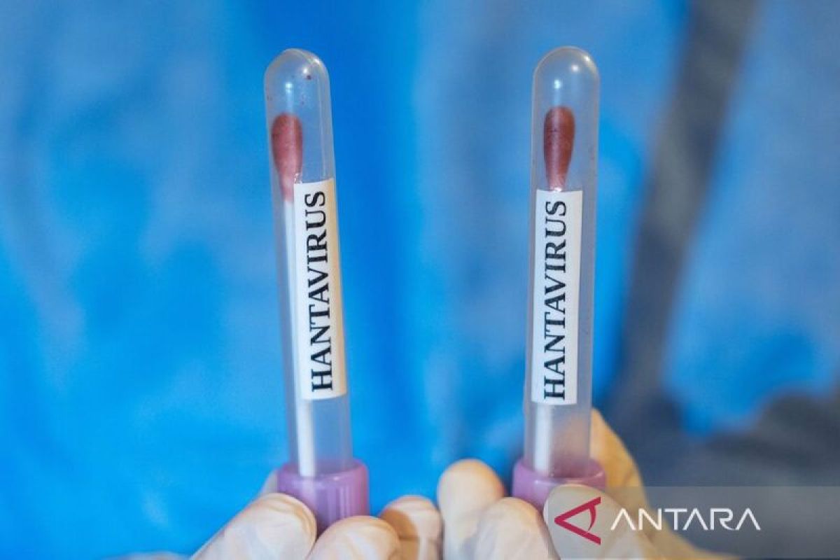 Dinkes sebut suspek hantavirus di Kulon Progo hasilnya negatif